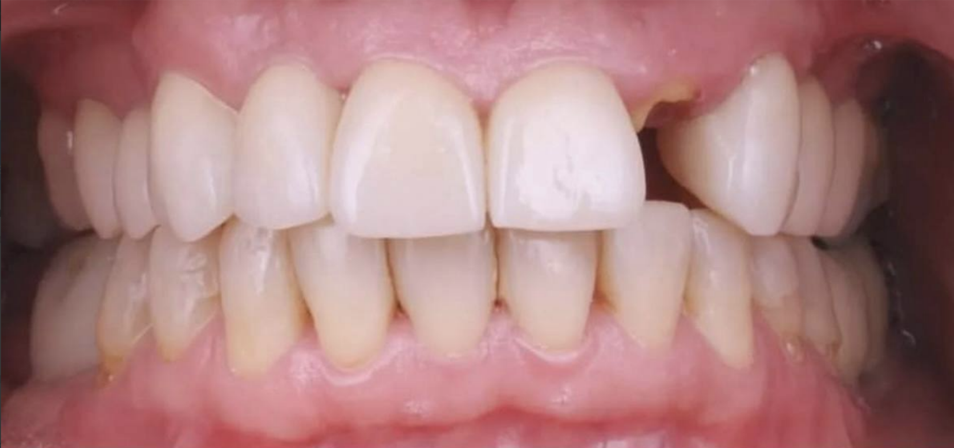 Стан шкіри до процедури №2